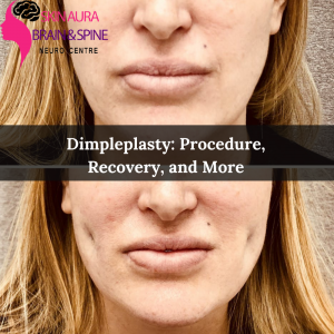 SAB Clinic - Dimpleplasty: Procedure, Recovery, and More