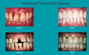 Periodontist Pembroke Pines