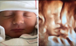 ultrasound new york city usa