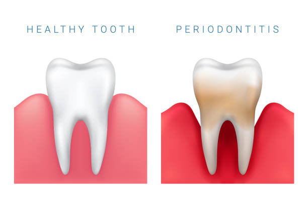 periodentist periodentist