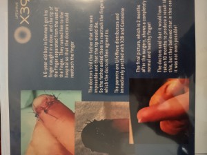 Football player wears the X39 Non-invasive patch for extra stamina during the game