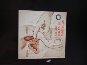 X39 heals a 7 inch cut in 2 months without a scar 