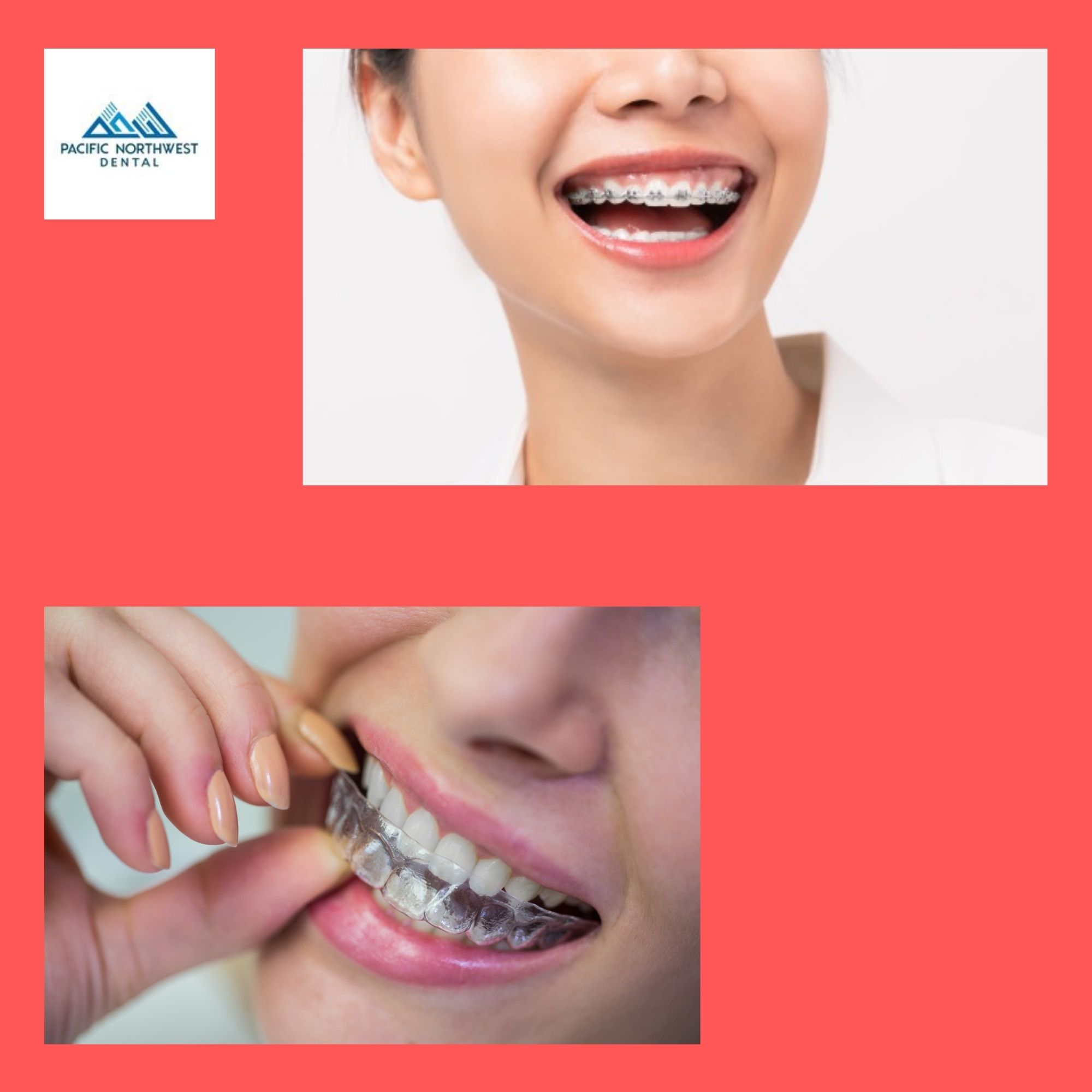 Now Avail CostEffective Restorative Dentistry Services From Pacific