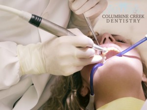 Root Canal Treatment Littleton