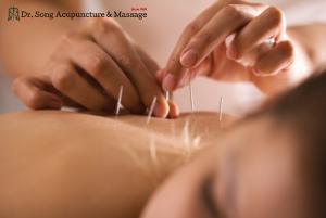 Dr Song Acupuncture & Massage Clinic