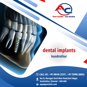 dental implants kundrathur