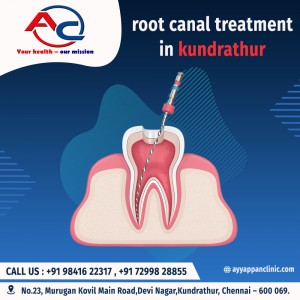 root canal treatment in kundrathur