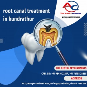 root canal treatment in kundrathur