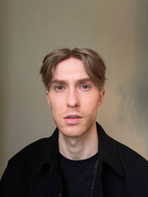 TikTokers Normalizing Use of Hair Toupees for Baldness Recovery 