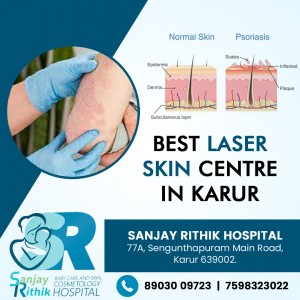 Best Laser Skin Centre In Karur