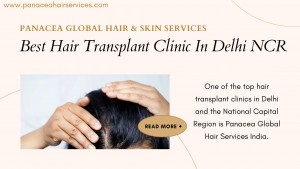 Best Hair Transplant Clinic In Delhi NCR