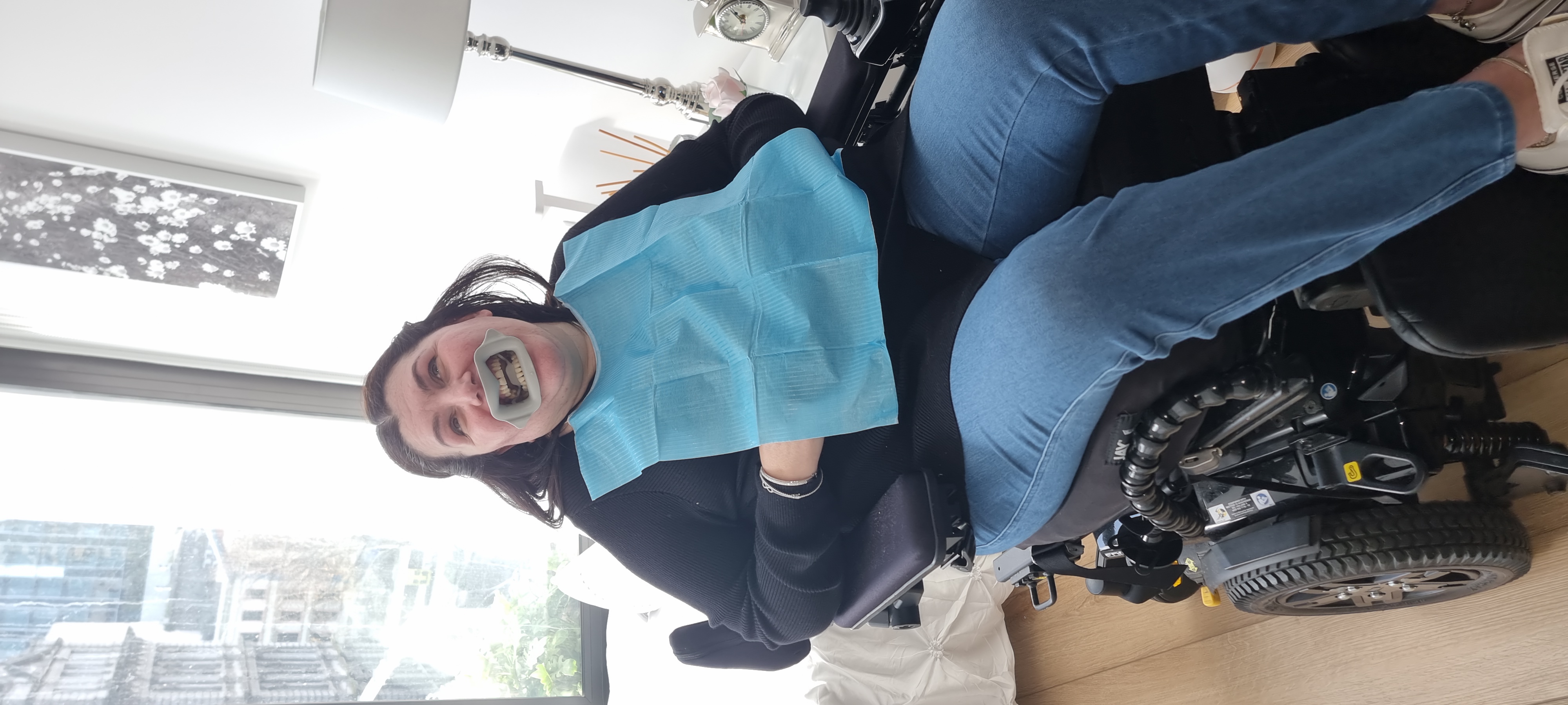 Teeth Bleaching Dentist in Melbourne Teeth Whitening Melbourne
