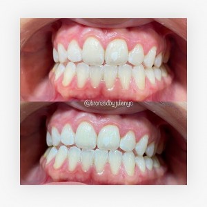 Upgraded Facilities at Bronzed By Julie – The Best tanning salon NYC 