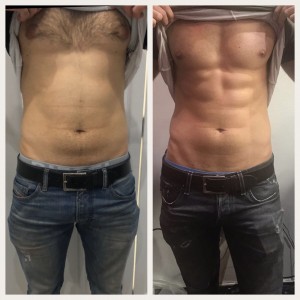 Before and after male