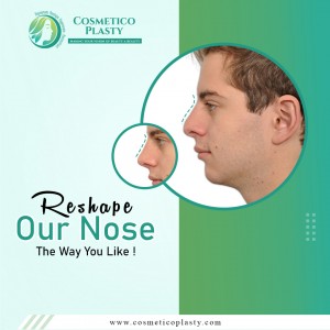 Cosmeticoplasty - Trending Top in Medical Aesthetics with Enhanced Services for Rhinoplasty, Tummy Tuck, & Gynecomastia