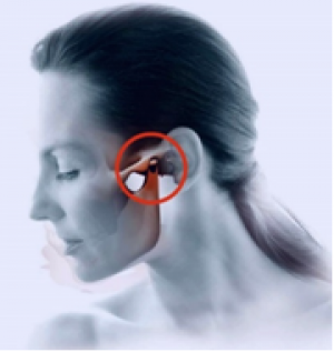 Craniomandibular Institute Announces Improved 3D Digital Splint Design