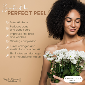 Perfect Peel