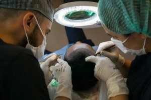 hair transplant