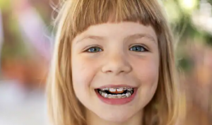 Braces in Bowling Green