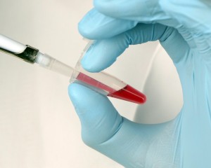 Pipetting reagents