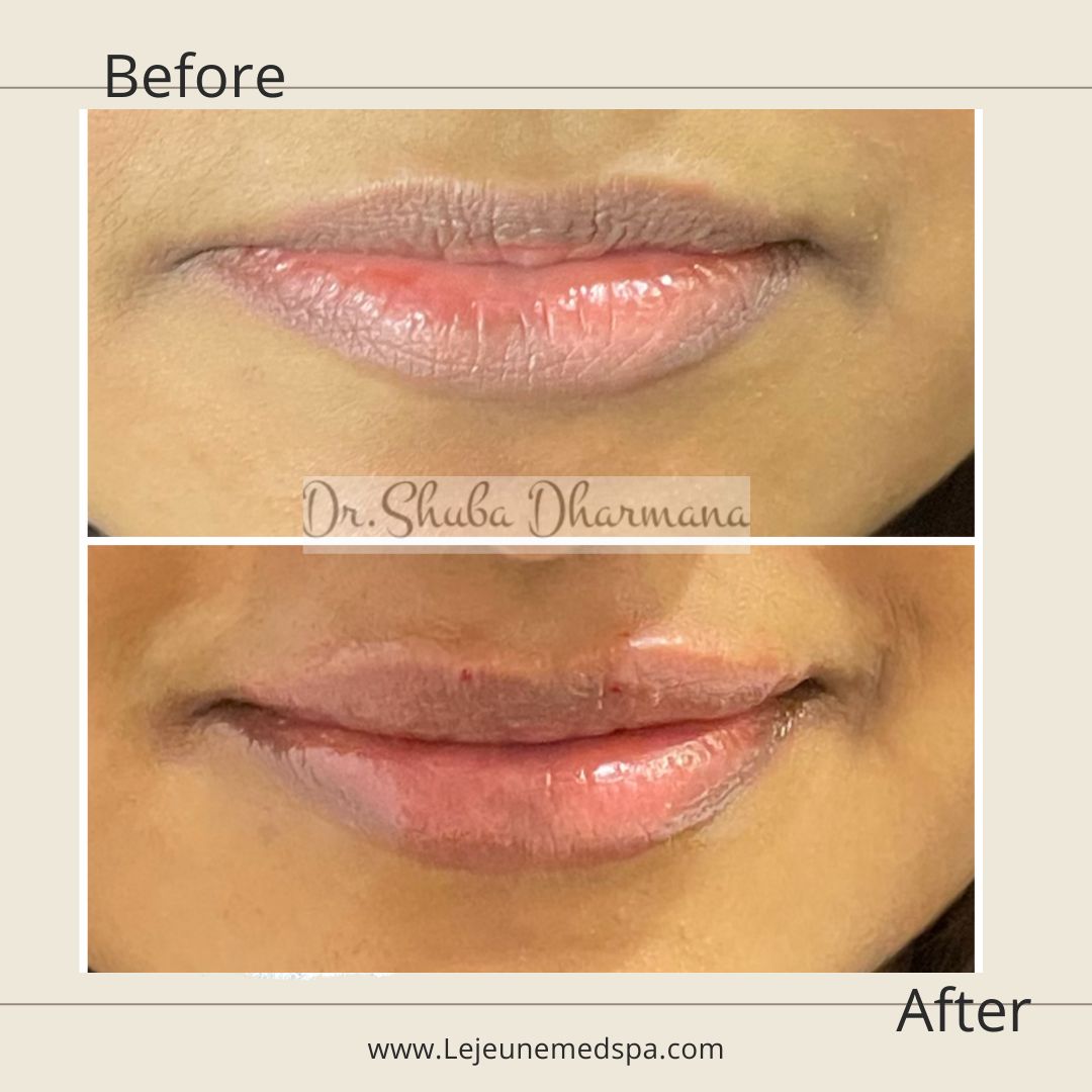 Recent Skincare and Beauty Trends Dermatology Trends with LeJeune