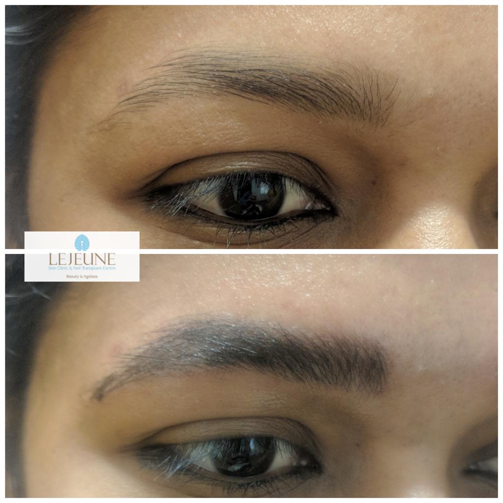 Recent Skincare and Beauty Trends Dermatology Trends with LeJeune