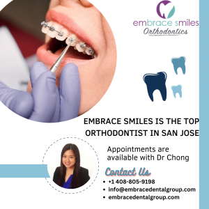 Embrace Smiles is the top Orthodontist in San Jose