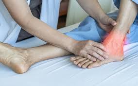 Plantar Fasciitis