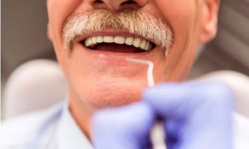 The Best Dental Insurance Plans for Seniors