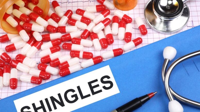 Shingles