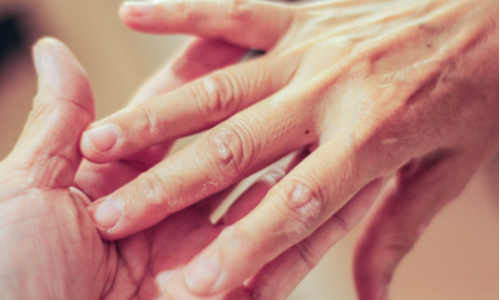 Know the Basics About Psoriasis and Psoriatic Arthritis