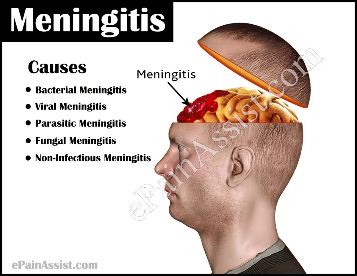 Meningitis