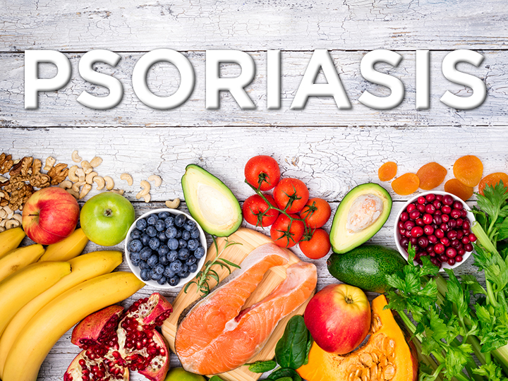 Natural Remedies For Psoriasis