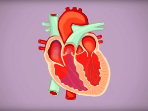 4 Stages Of Congestive Heart Failure