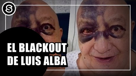 Luis Alba