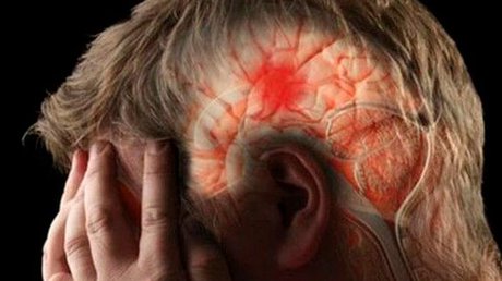 cerebro1.jpg