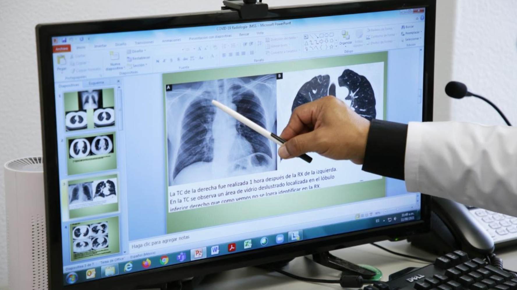 imss daños covid pulmones.jpg