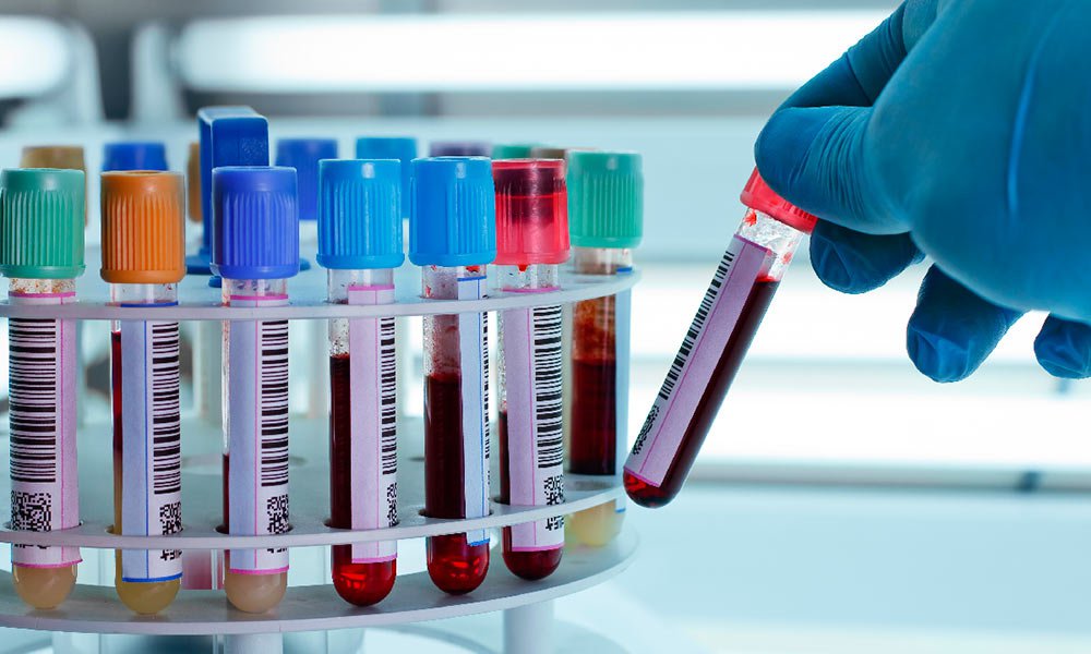 laboratorio-analisis.jpg