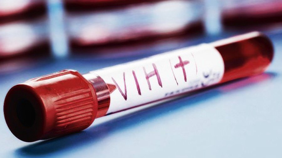 prueba VIH.jpg