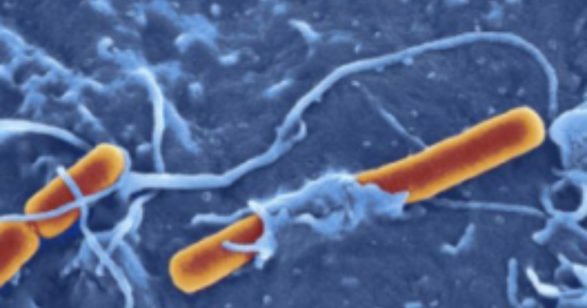 Shigella Lawyer Shigella Food Poisoning Outbreak Lawsuits