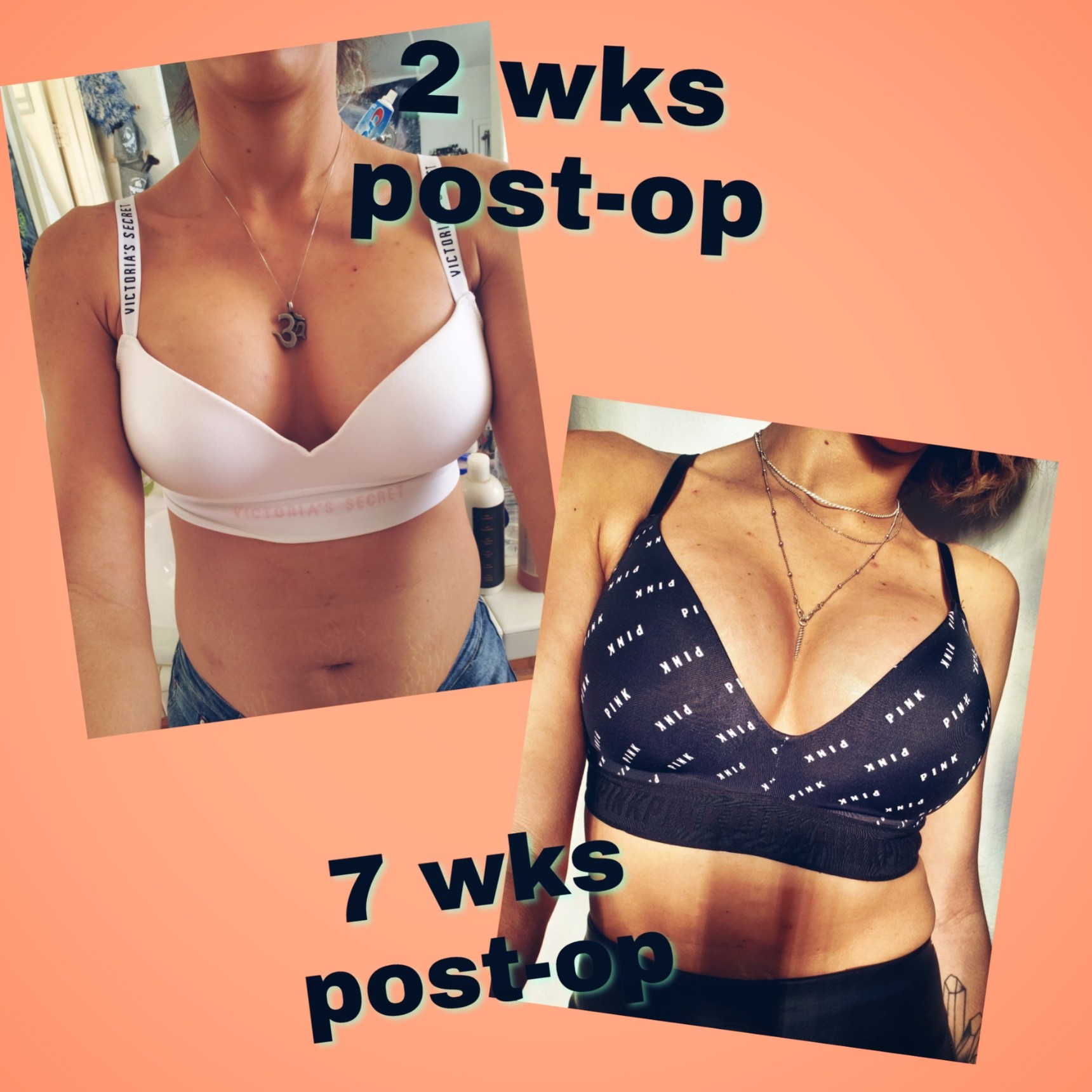 PostOp Drop/Fluff Weeks 1 8 Comparison Eden's Bustmob