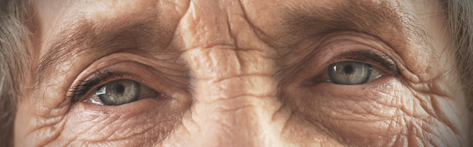 AGE-RELATED MACULAR DEGENERATION