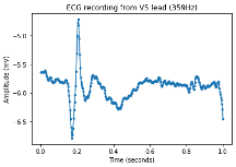 PubMed Search result with abstract overview