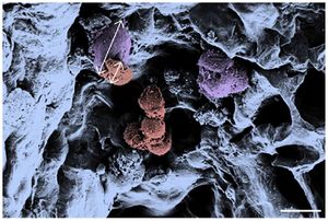 Fig. 11: Pseudo colored scanning electron micrograph of a porous hydrogel seeded with primary MSC-BM and HSPCs. The cell types can be distinguished by morphology and size as depicted by the arrows. Purple: adherent MSC-BM, ~28 μm in size; red: HSPCs, ~12 μm in size. Scale bar, 20 μm [29]