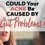 acne-150x150.jpg
