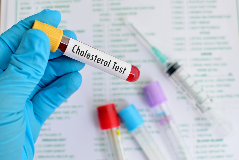 Blood-sample-for-cholesterol-testing.jpg