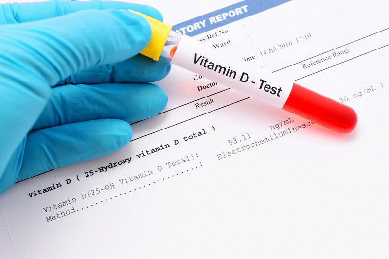 Vitamin-D-test.jpg