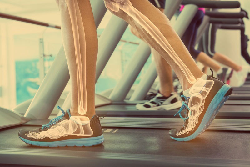 Highlighted-bones-of-man-on-treadmill.jpg