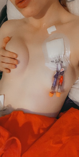 Being A Disabled Sex Worker2