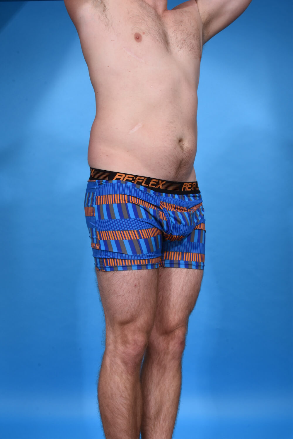 Abdominal Etching with High Definition Liposculpting | Dr. Daniel O. Beck